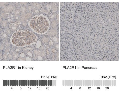 hpa012657-ihc-n hpa012657-ihc-n