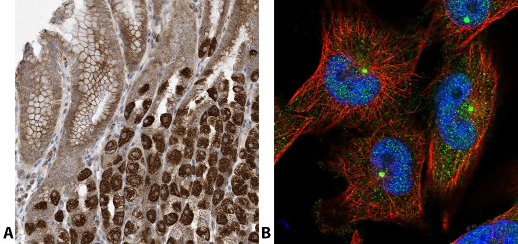 Anti-C2ORF74 Antibody-B & Anti-C2ORF74 Antibody-A Staining with anti-C2ORF74 polyclonal antibody (Cat. No. <a href="/product/sigma/hpa026826">HPA026826</a>). (A) Immunohistochemical staining of human stomach shows strong cytoplasmic positivity in parietal cells. (B) Immunofluorescent staining of human cell line U-251 MG shows positivity in centrosome and nucleus but excluded from the nucleoli.