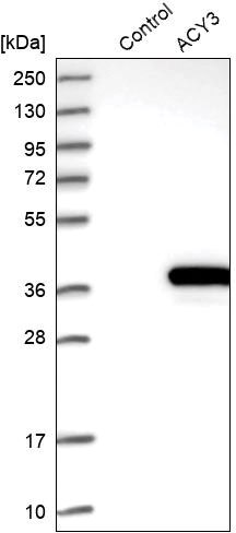 Expression/Overexpression Validation Expression/Overexpression Validation