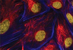 Immunofluorescence. Imna(-/-) mouse embryonic fibroblasts stained with Monoclonal Anti-Vimentin, clone LN-6 (Cat. No. V2258) at a 1:40 dilution (red), Anti-Actin (blue) and DAPI (yellow). From Shyam Khatau, Department of Chemical and Biomolecular Engineering, Johns Hopkins University, Baltimore, MD. Immunofluorescence. Imna(-/-) mouse embryonic fibroblasts stained with Monoclonal Anti-Vimentin
