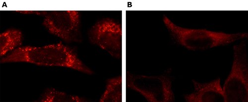 immunofluorescence immunofluorescence