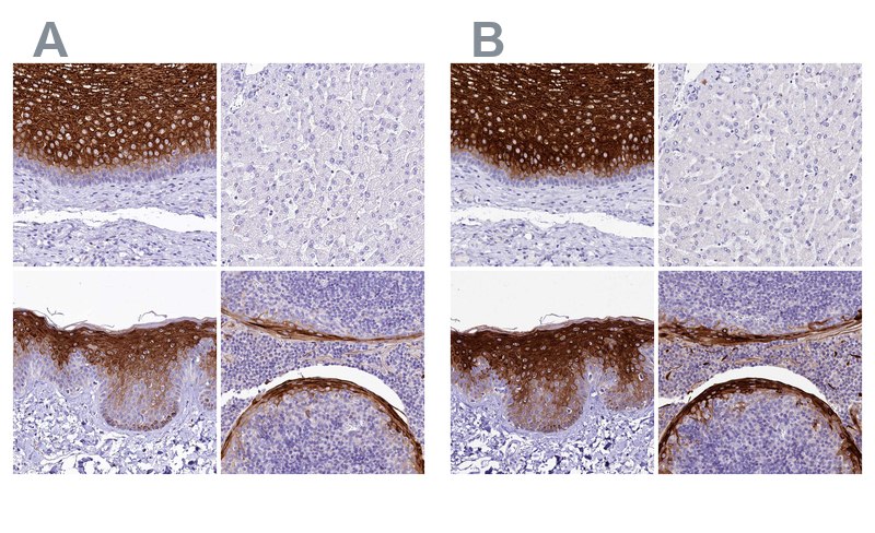 Immunohistochemical staining Immunohistochemical staining of human esophagus, liver, skin, and tonsil using Anti-A2ML1 antibody HPA038847 (A) shows similar protein distribution across tissue to independent antibody HPA038848 (B).