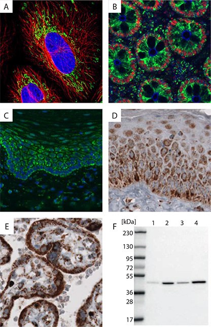 Mitochondria can be detected by using an antibody directed against TUFM(Tu translation elongation factor), a protein specifically expressed in mitochondria. The anti-TUFM monoclonal antibody, AMAb90966, shows a specific signal in a variety of applications, including immunofluorescence immunocytochemistry (IF-ICC), chromogenic and fluorescence immunohistochemistry (IHC and IF-IHC), as well as in Western Blot (WB). A) IF-ICC staining of HeLa cell line with AMAb90966 shows distinct immunoreactivity in mitochondria (in green). Nuclei are displayed in blue (DAPI) and microtubules in red. B) IHC-IF staining of human colon tissue with mitochondrial Anti-TUFM immunoreactivity shown in green, plasma membranes in blue (Anti-EZR, AMAb90979, IgG2b) and nuclei in red (Anti-HNRNPC, AMAb91010, IgG2a). This illustrates that three mouse monoclonal antibodies of different subtypes can be used simultaneously when detected with subtypes-specific secondary antibodies. C) IHC-IF staining of human skin with Anti-TUFM immunoreactivity shown in green and nuclei in blue. D) IHC staining of human skin and E) placenta. F) WB analysis of human cell lines U251 MG (1), A-431 (2), U-2 OS (3) and MCF-7 (4). Anti-TUFM, Example of an Organelle Marker