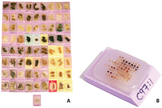 tissue-microarrays Tissue Microarray