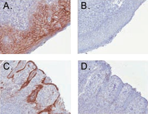 Enhanced Antibody Validation for Immunohistochemistry using anti-desmoglein in human tonsil tissue. Enhanced Antibody Validation for Immunohistochemistry using anti-desmoglein in human tonsil tissue.