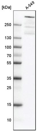 Western blot analysis using anti-ATRX antibody Western blot analysis using anti-ATRX antibody