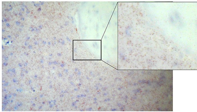 Count Duolink signals in counterstained area using Duolink Image Tool duolink brightfield detection