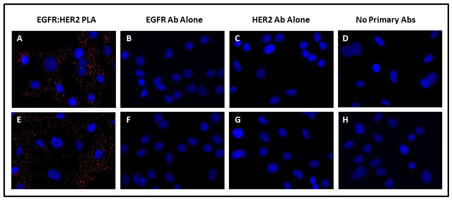 Portaobjetos de células SK-OV3 fijadas y tratadas con EGF se incubaron con anticuerpos anti-EGFR de ratón y anti-HER2 de conejo (A, E), anticuerpos anti-EGFR solo (B, F), anticuerpos anti-HER2 solo (C, G) o diluyente de anticuerpos solo (D, H) durante 2 horas a 37 °C (A-D) o durante la noche a 4 °C (E-H). A continuación se realizó el PLA DuoLink<sup>®</sup> utilizando sondas de PLA PLUS anti-conejo y MINUS anti-ratón. Se adquirieron diez imágenes aleatorias 20x por pocillo utilizando los filtros DAPI (núcleos azules) y Cy5 (señales de PLA rojas). Las imágenes son representativas de al menos 5 experimentos independientes. Detección de la dimerización EGFR:HER2 inducida por EGF usando el PLA DuoLink®