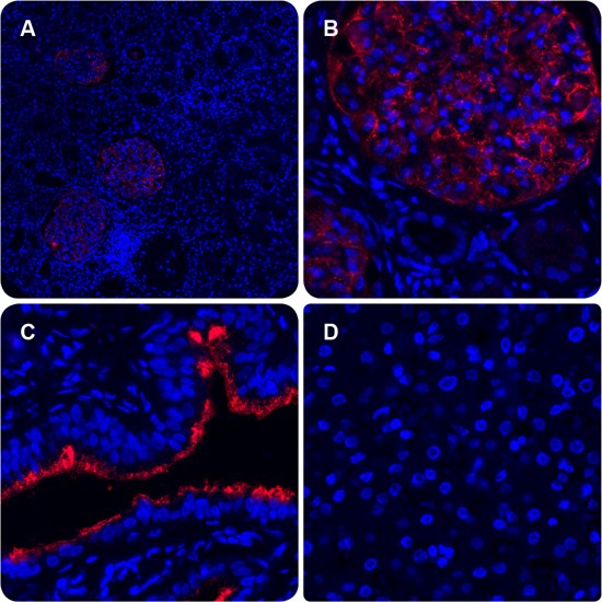 Immunofluorescence PLA signal shows protein-protein interactions
