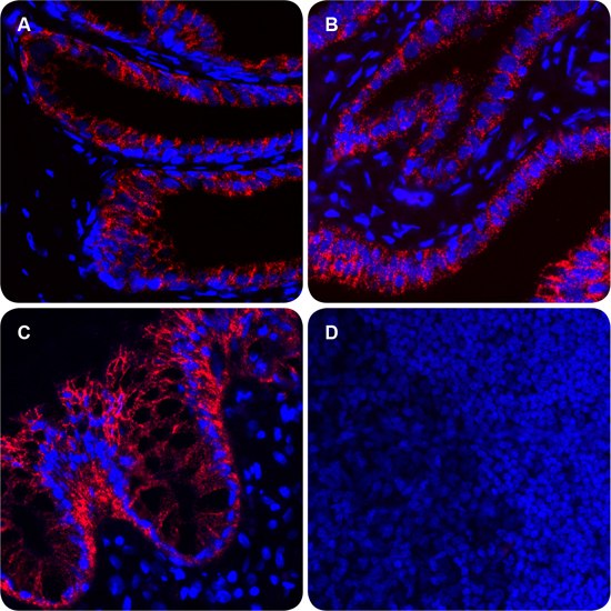 Immunofluorescence is PLA signal