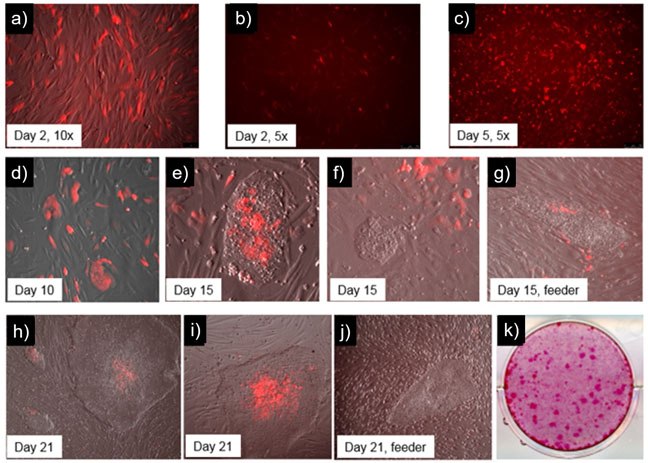 Time-course-human-iPSC-fig6 Time course of human iPSC colonies