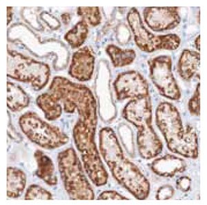 Cat. No. HPA036223: Immunohistochemical staining of human kidney shows strong cytoplasmic positivity in cells in tubules. Anti-GLS