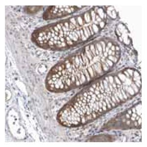 Cat. No. HPA036092: Immunohistochemical staining of human colon shows moderate cytoplasmic positivity in glandular cells. Anti-PPAT