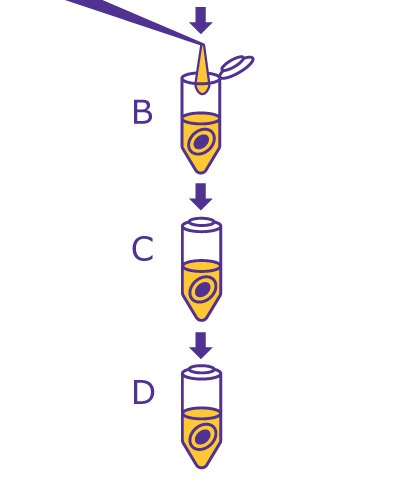 2nd step of the In-Solution Deglycosylation workflow starting with adding denaturant and incubating then cooling to room temp. 2nd step of the In-Solution Deglycosylation workflow starting with adding denaturant and incubating then cooling to room temp.