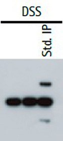 Western Blot Analysis of Immunoprecipitation (IP-Western) In a cross-linking IP western, the heavy and light chains of the primary capture antibody are excluded from the sample.