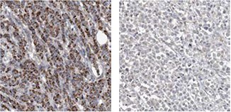 anti-acsf2-antibody anti-acsf2-antibody