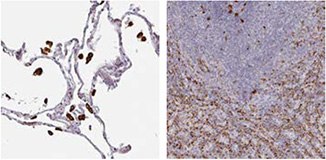 CD68/Macrosialin CD68/Macrosialin