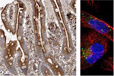 ihc-analysis-using-the-anti-grn-antibody ihc-analysis-using-the-anti-grn-antibody