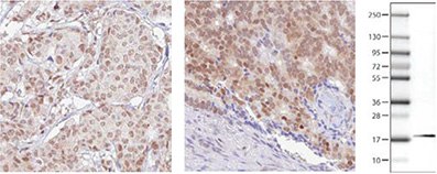 Immunohistochemical analysis of RBM3 expression in breast cancer (left) and prostate cancer (right) using AMAb90655 shows nuclear positivity in tumor cells. The WB image shows an expected band of 17 kDa in human cell line RT4 lysate using AMAb90655. RBM3 Antibodies