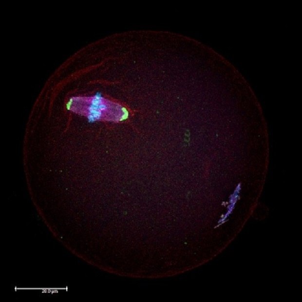 Microscopic image of a mouse oocyte Imagen microscópica del ovocito de ratón en la metafase II meiótica.