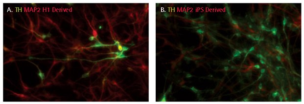 Dopaminergic differentiation of iPSC derived NPCs. After 14 days of differentiation, dopaminergic neurons were characterized by following the expression of tyrosine hydroxylase (TH). 10-30% cells were positive for tyrosine hydroxylase. Dopaminergic differentiation of iPSC derived NPCs