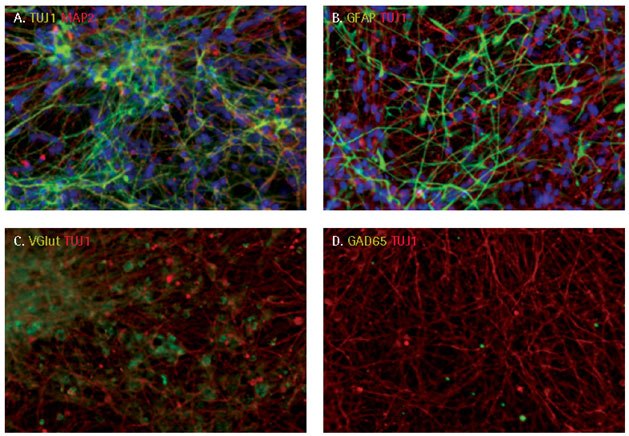 Neuronal differentiation of iPSC derived NPCs. After 9 days of differentiation, cells showed extended, elaborate neurite networks. The majority of the differentiated cells expressed neuronal markers, TUJ1 and MAP2 (A) with some cells differentiating to GFAP+ astrocytes. (B). Terminally differentiated cells were preferentially glutaminergic (C) rather than GABAergic neurons (D). Neuronal differentiation of iPSC derived NPCs.