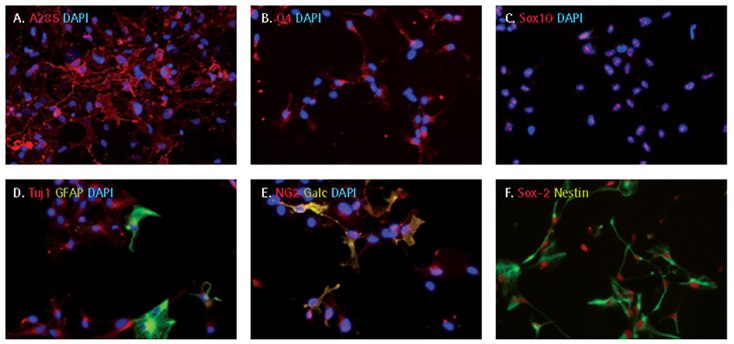 Oligodendrocyte differentiation of iPS cell derived NPCs. Cells were cultured as neurospheres in oligodendrocyte expansion medium and small molecules for 14 days before plating on poly-L-ornithine- and laminin-coated plates for immunocytochemical analyses for A2B5 (A), O4 (B), Sox10 (C), TUJ1 and GFAP (D), NG2, GalC (E), Sox-2 and Nestin (F) . Over 80% cells were A2B5-, O4- or Sox10-positive, 10% GFAP-positive, and 30% positive for GalC. Oligodendrocyte differentiation of iPS cell derived NPCs