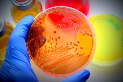 Bacterial growth on an agar plate A gloved hand holding a petri dish containing orange agar with visible bacterial growth, surrounded by colorful culture bottles in the background