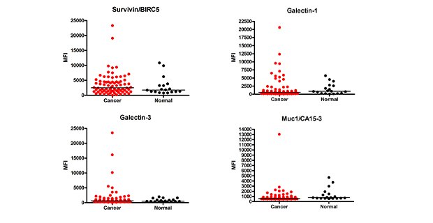 Cancer Autoantibody Analysis Graph showing data for cancer autoantibody analysis. Using MILLIPLEX® Human Cancer Autoantibody Panel Cat. No. HCABMAG-13K, the MFI (Median Fluorescence Intensity) values of the cancer autoantibody biomarkers were determined in cancer (breast, colorectal, ovarian, lung, prostate) (n=78) and healthy control (n=18) serum samples (samples diluted at 1:100).