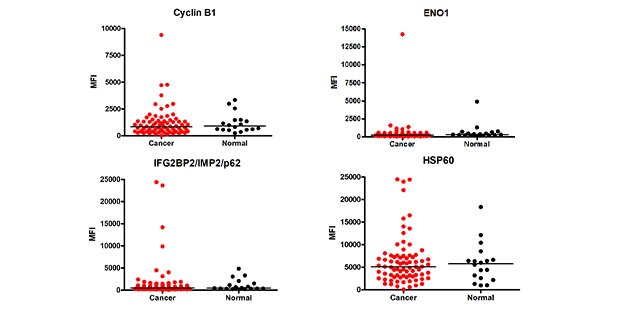 Cancer Autoantibody Analysis Graph showing data for cancer autoantibody analysis. Using MILLIPLEX® Human Cancer Autoantibody Panel Cat. No. HCABMAG-13K, the MFI (Median Fluorescence Intensity) values of the cancer autoantibody biomarkers were determined in cancer (breast, colorectal, ovarian, lung, prostate) (n=78) and healthy control (n=18) serum samples (samples diluted at 1:100).