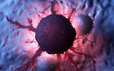 Cancer Biomarker Image of a general cancer biomarker that can be detected by multiplex cancer immunoassays.