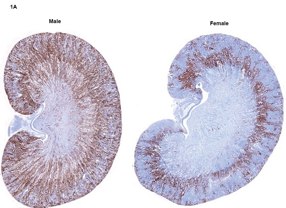 Male vs Female Immunohistochemistry Rat Nephrotoxicity Analysis of KIM-1 Image of immunohistochemistry nephrotoxicity analysis of male and female rat kidneys for localization of KIM-1 on Day 8 of high-dose vancomycin treatment.