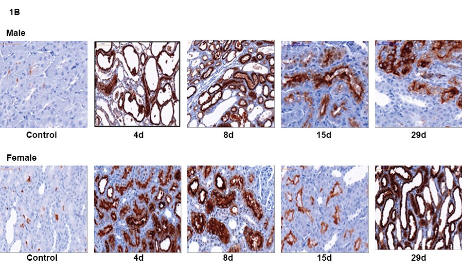 Time Course of KIM-1 Expression in Rat Kidneys Images of immunohistochemistry nephrotoxicity time-course analysis of male and female rat kidneys for localization of KIM-1 over 29 days of high-dose vancomycin treatment.