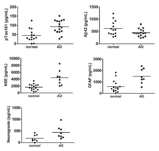 MILLIPLEX® Multiplex Biomarker Analysis of Normal and AD CSF Samples MILLIPLEX® multiplex biomarker analysis of normal and AD CSF samples, including pTau181, NSE, Neurogranin, Aβ42, and GFAP.