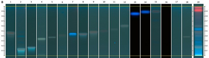 Chromatograms under UV Chromatograms under UV