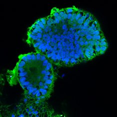 CA-II CA-II/DAPI