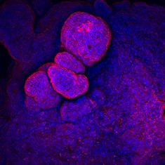 CA-IV CA-IV/DAPI