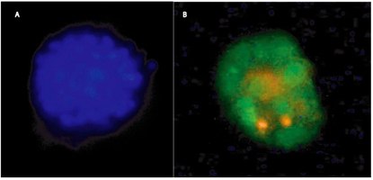 Cultrex® 3-D Culture Matrix™ Laminin I Protocol 3-D Culture of MCF-10A Breast Cancer Cells using 3-D Culture Matrix™ Laminin I for 15 days in the presence of 2% Liminin I in Assay Medium, and stained using A) CPA Dye 2, and B) SYBR® Green (nuclear) and propidium iodine (dead or necrotic).