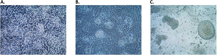 Differentiation of definitive endoderm cells into hindgut endoderm cells. Differentiation of definitive endoderm cells into hindgut endoderm cells. Morphology of hindgut endoderm cells at A) day 2 B) day 3 and C) day 4 post hindgut endoderm induction.