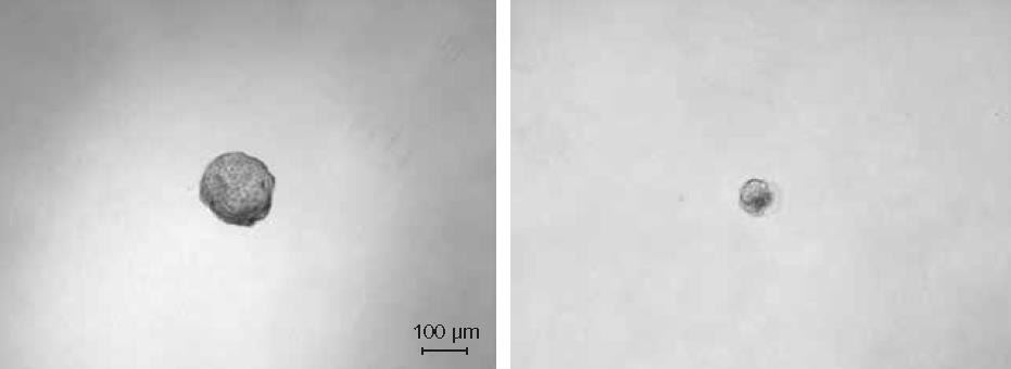 Tumor Spheroid Formation Assay Expected results from an in vitro spheroid formation assay