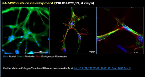 Microscopy images of human adipose MSCs cultured in 3D using TrueGel3D HTS hydrogel plates. Keywords: MSC, mesenchymal stem cells, truegel3d Microscopy images of human adipose MSCs cultured in 3D using TrueGel3D HTS hydrogel plates. Keywords: MSC, mesenchymal stem cells, truegel3d