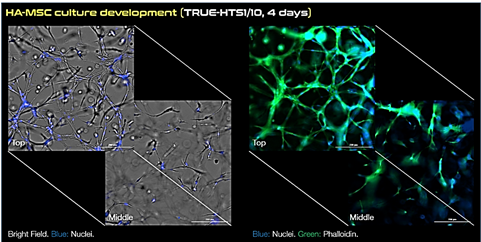 Microscopy images of human adipose MSCs cultured in 3D using TrueGel3D HTS hydrogel plates. Keywords: MSC, mesenchymal stem cells, truegel3d Microscopy images of human adipose MSCs cultured in 3D using TrueGel3D HTS hydrogel plates. Keywords: MSC, mesenchymal stem cells, truegel3d