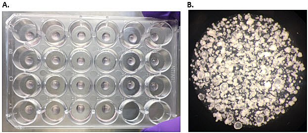Human colon organoids. Human colon organoids. A) Colonic organoids encapsulated in Matrigel® matrix domes, two days post-thaw. B) By day 10-12 in culture, colon organoids occupy 85-90% of the dome, and are ready to be passaged.