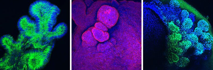 Protocol Guide: Immunofluorescent Staining of Whole-Mount Organoids using Antibodies Immunofluorescence of organoids using antibodies