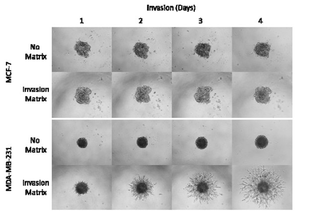 mcf-7-mda-mb-231-morphology Morphology of MCF-7 and MDA-MB-231 cell