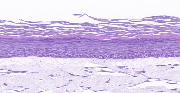 Millicell Skin Anti-Flaggrin Stain Organotypic skin models contain actively proliferating keratinocytes. (B)