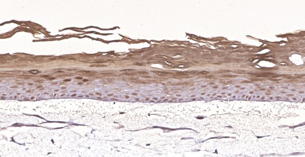 Millicell Skin Basal Layer Organotypic skin models contain actively proliferating keratinocytes. (C)