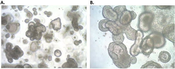 Morphology of human iPS cell-derived colonic organoids Morphology of human iPS cell-derived colonic organoids. Mature human colon organoids have complex morphologies when cultured in three dimensions. A) 4X magnification B) 10X magnification.