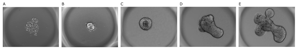 Mouse intestinal organoids grown on Millicell® Microwell plates Mouse intestinal organoids grown on Millicell® Microwell plates over time