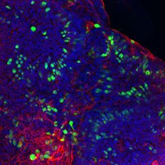 Mucin-2 Mucin-2/F-Actin/DAPI